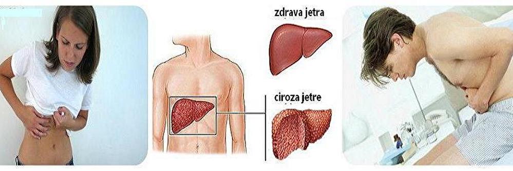 jetra